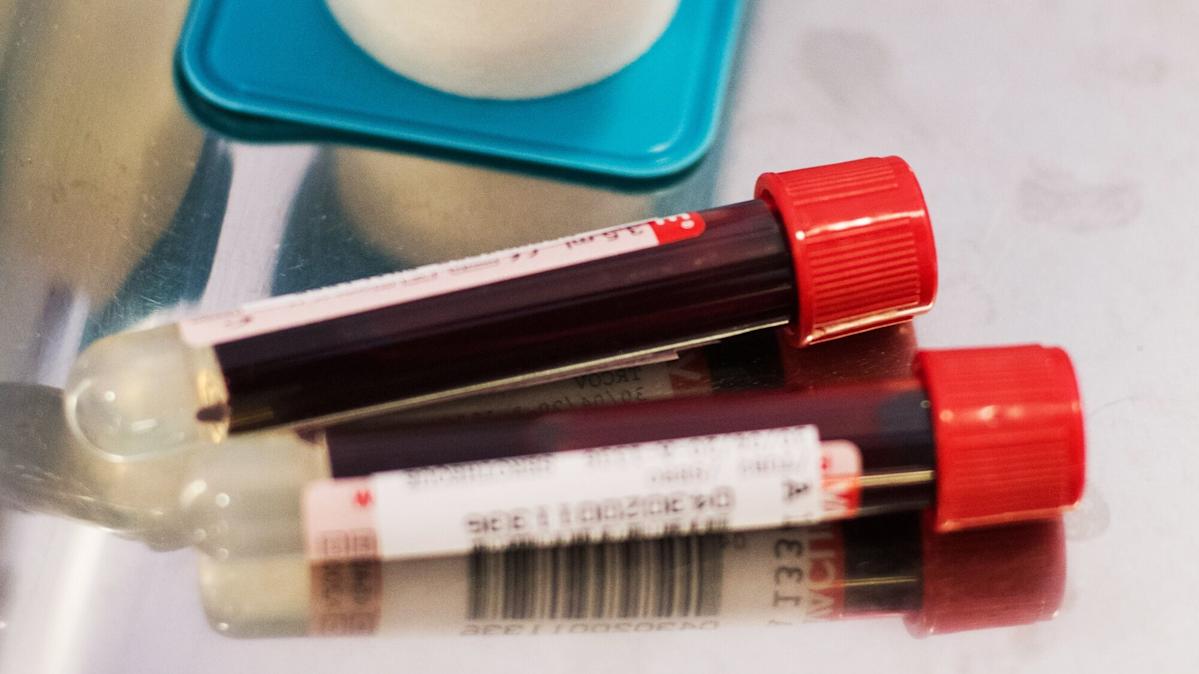 <br />
<b>Warning</b>:  Undefined variable $myimgalt in <b>/www/wwwroot/awdailynews.cn/wp-content/themes/ennews001/single.php</b> on line <b>213</b><br />
